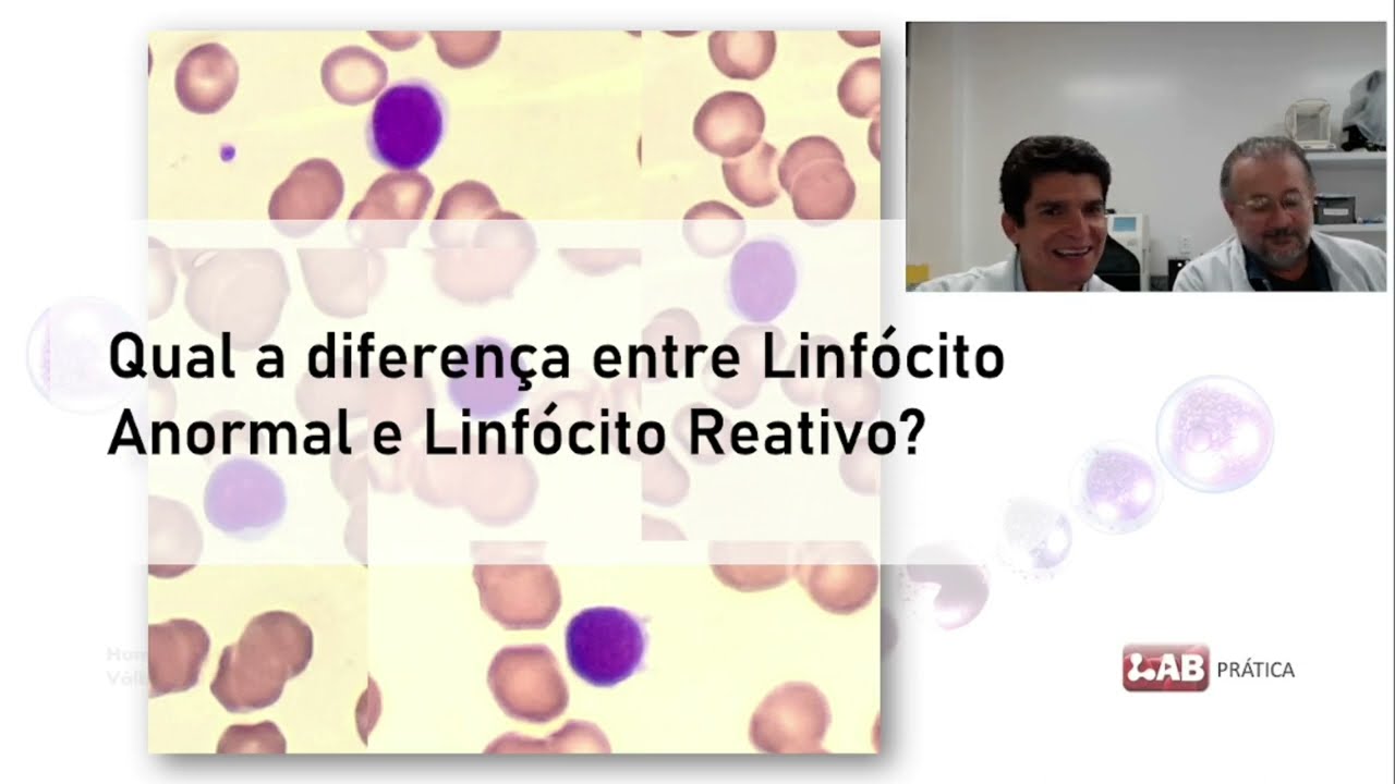 Qual a diferença entre Linfócito Anormal e Linfócito Reativo?