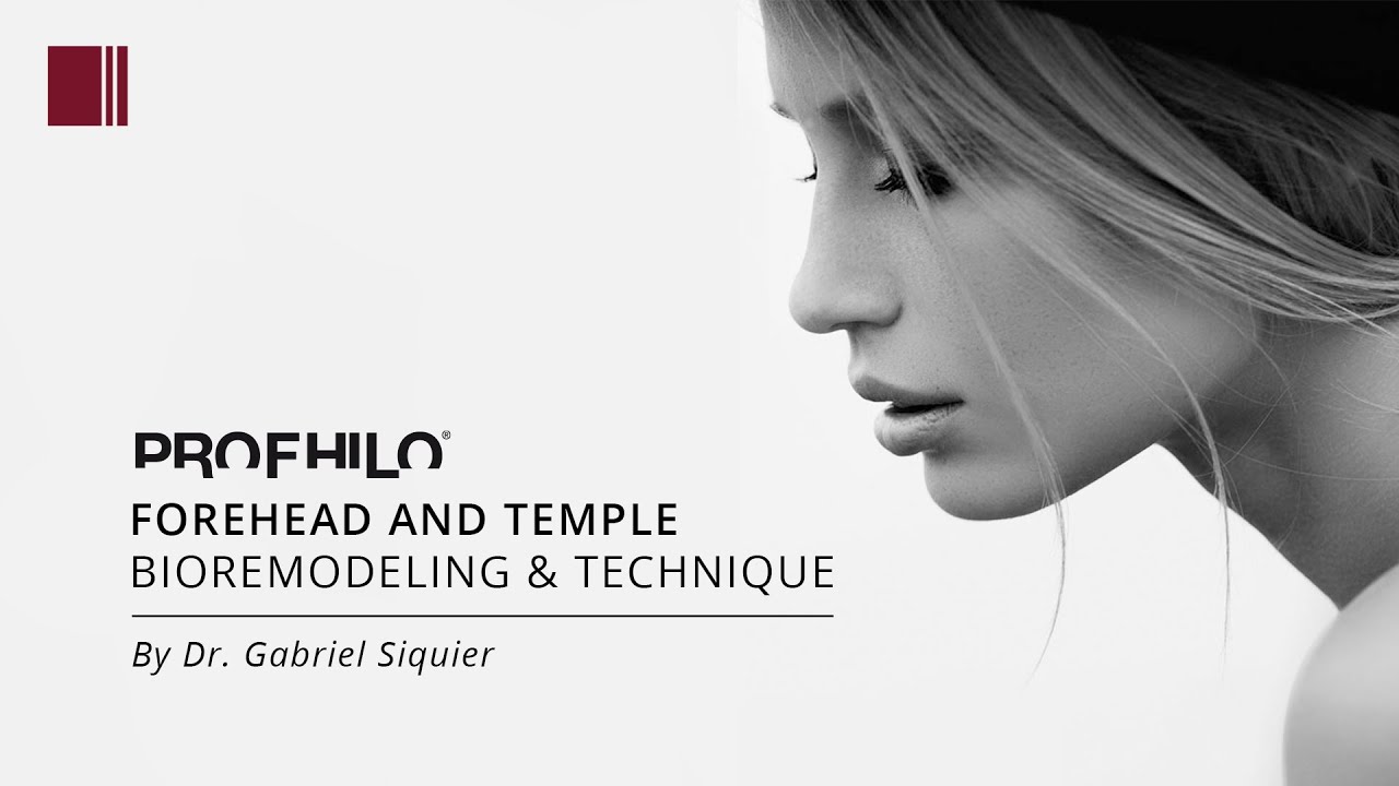 Profhilo Forehead and Temple by Dr. Gabriel Siquier
