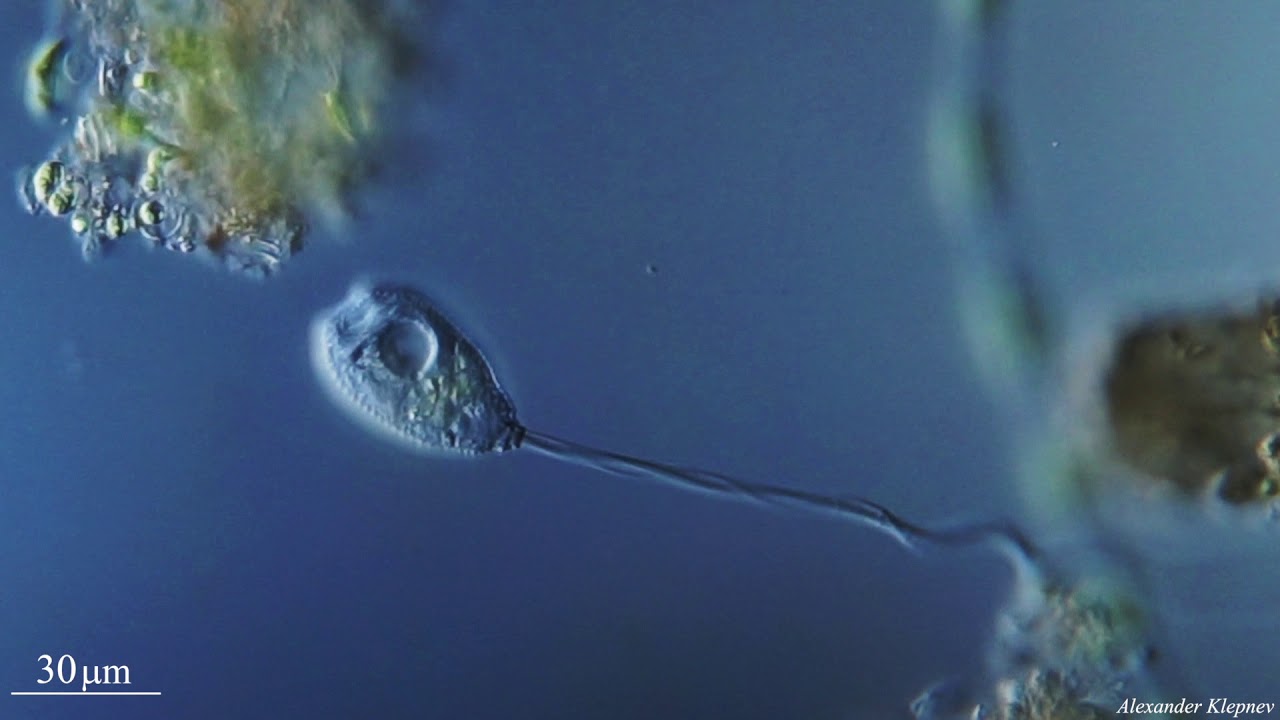 Vorticella