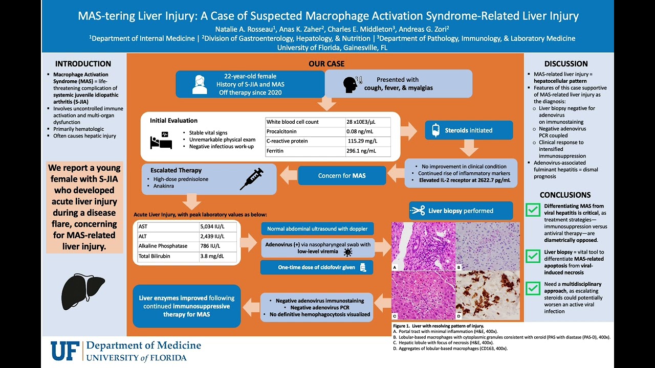 MAS-tering Liver Injury: A Case of Suspected Macrophage Activation Syndrome-Related Liver Injury