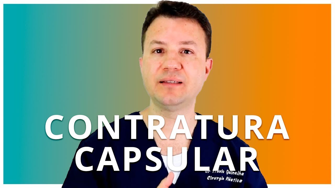 CONTRATURA CAPSULAR em Prótese de Mama