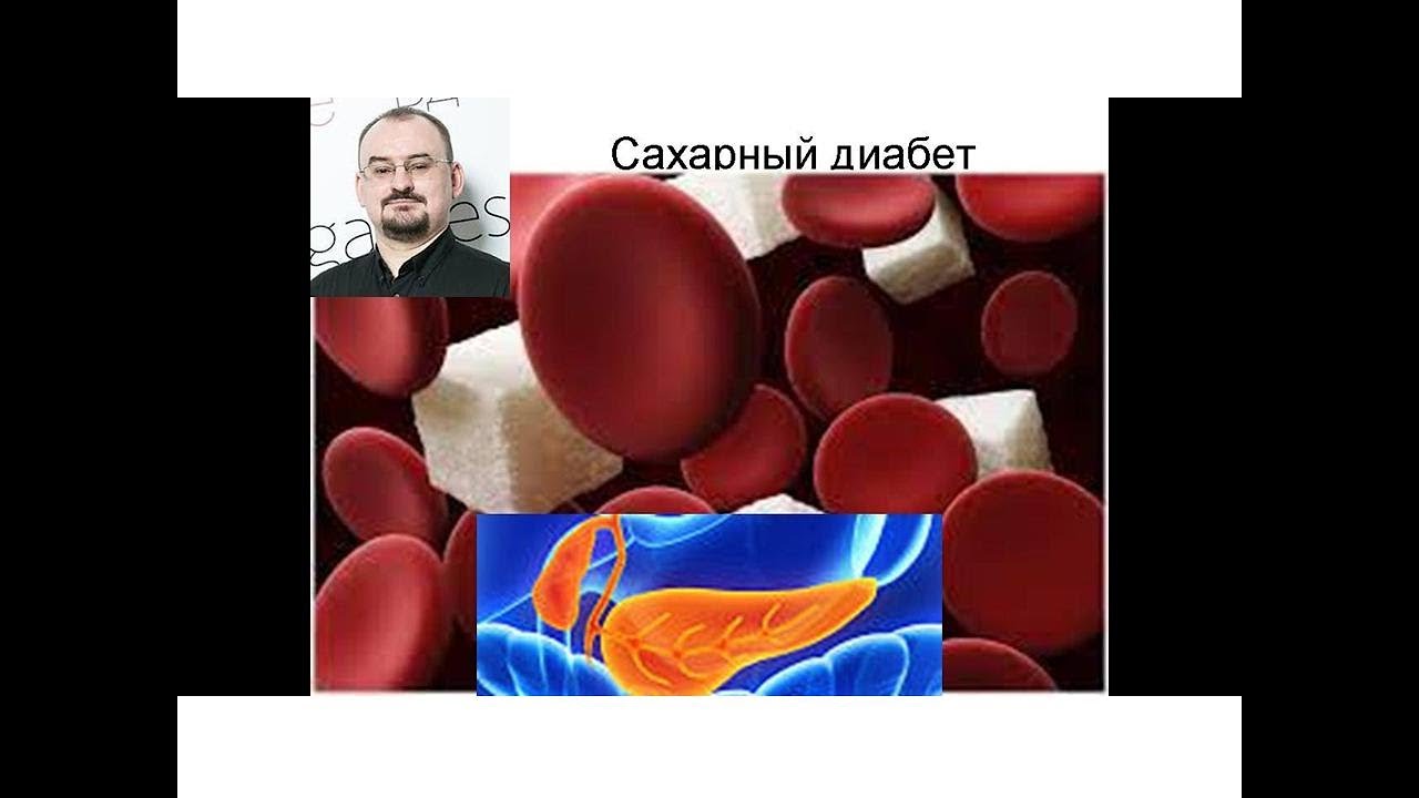 Эндокринная часть поджелудочной железы. Сахарный диабет, первый и второй тип.