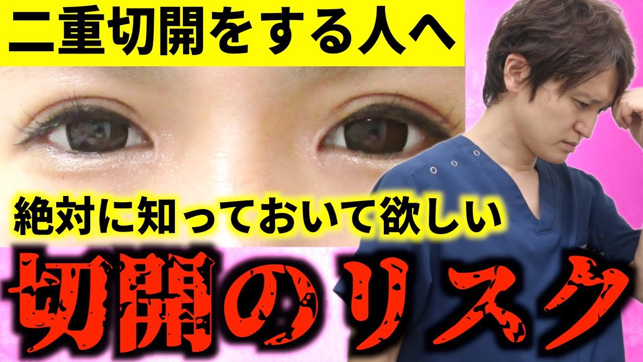 【警告】二重切開前に絶対に確認しておくべきこと