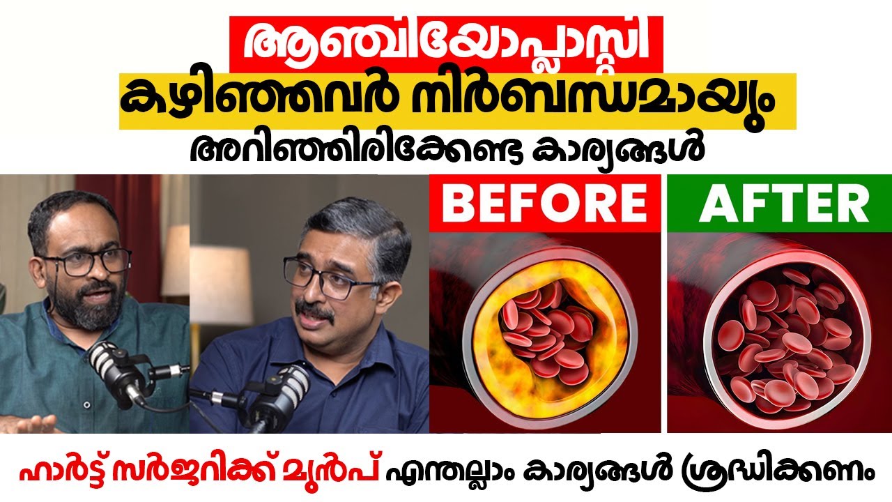 ആഞ്ചിയോപ്ലാസ്റ്റി  കഴിഞ്ഞവർ നിർബന്ധമായും അറിഞ്ഞിരിക്കേണ്ട കാര്യങ്ങൾ | Angioplasty | Arogyam Podcast
