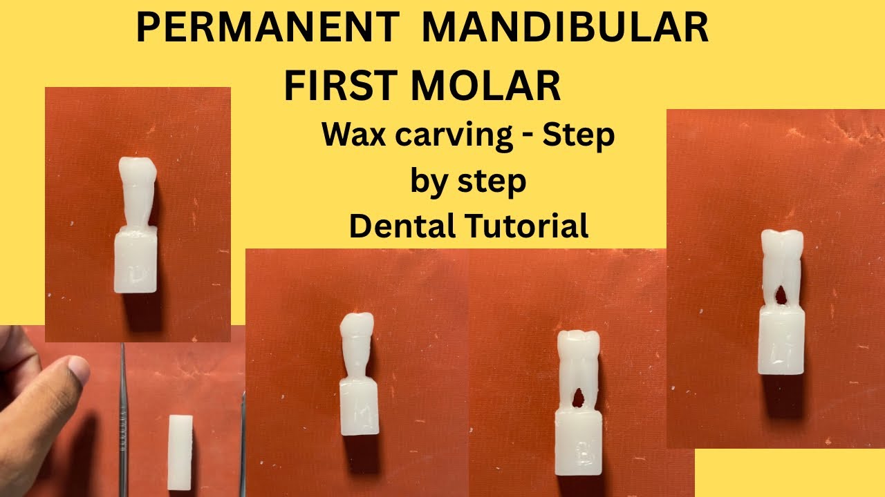 Permanent mandibular first molar | wax carving step by step | Dental tutorial