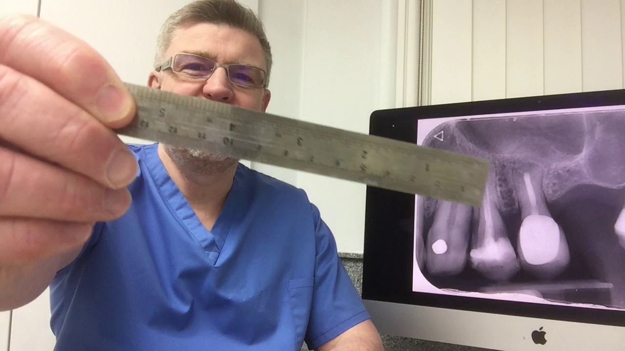 Customising the master cone