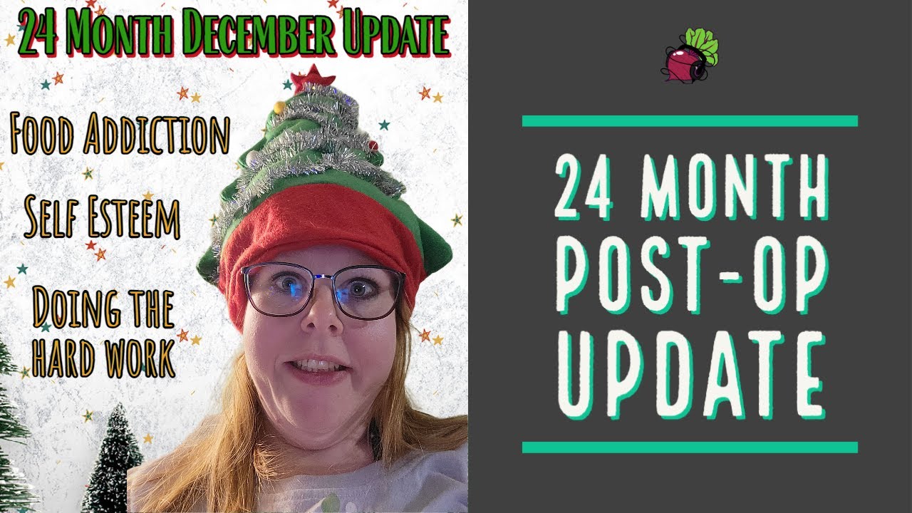 24 Month Post-Op Update // Bariatric Surgery in Mexico | My Gastric Bypass Journey