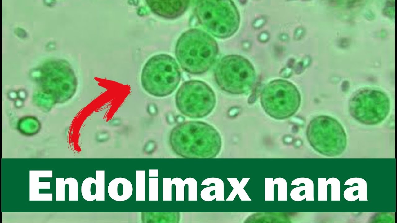Endolimax nana visto ao microscópio óptico | identificando cistos de Endolimax nana