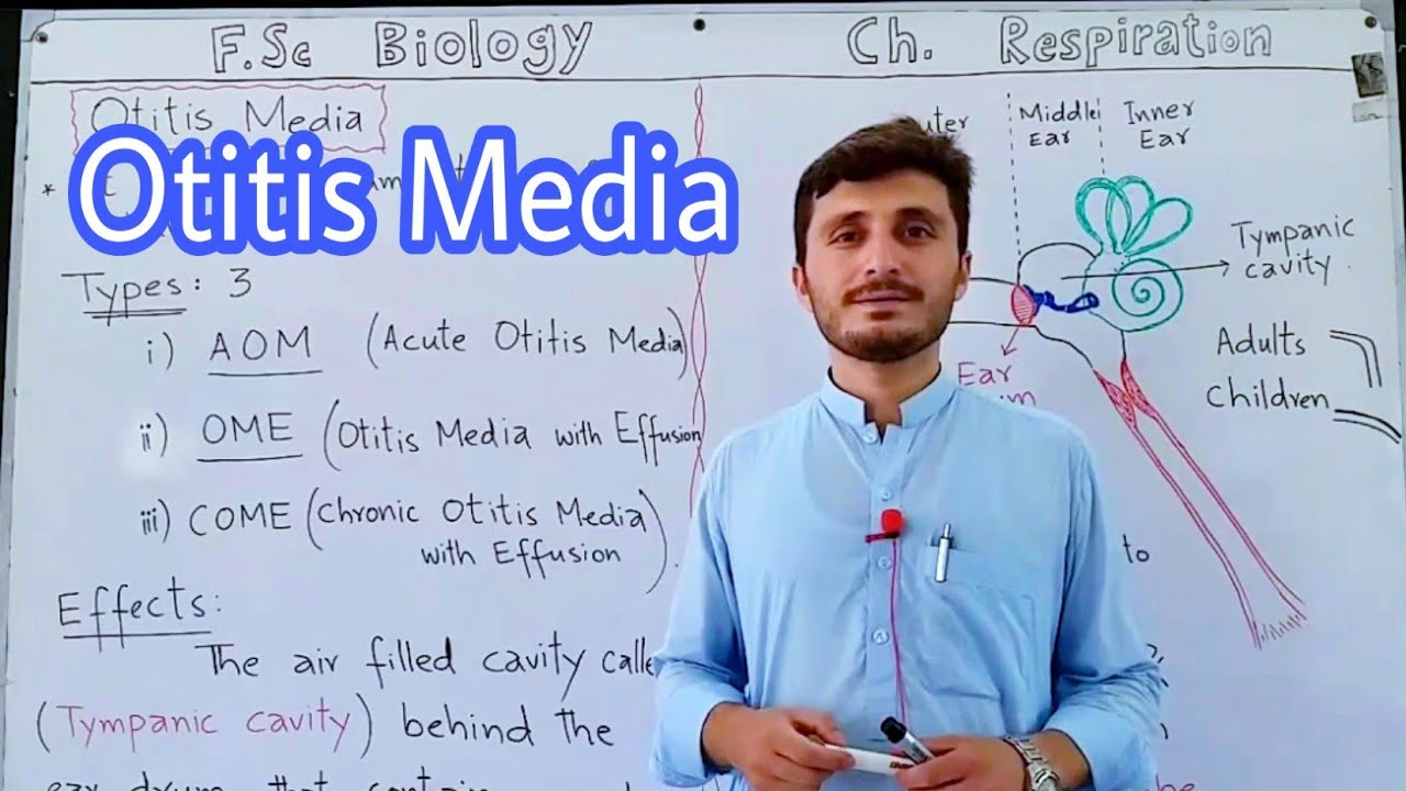 Otitis Media | Middle Ear Infection | Acute Otitis Media | Otitis Media with Effusion | COME