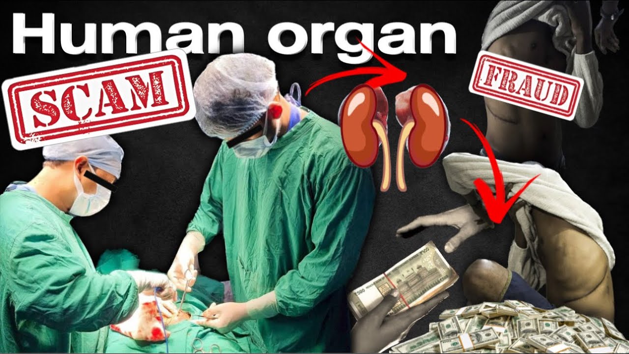 Незаконная торговля человеческими органами в Индии 💰 | @doctorduo