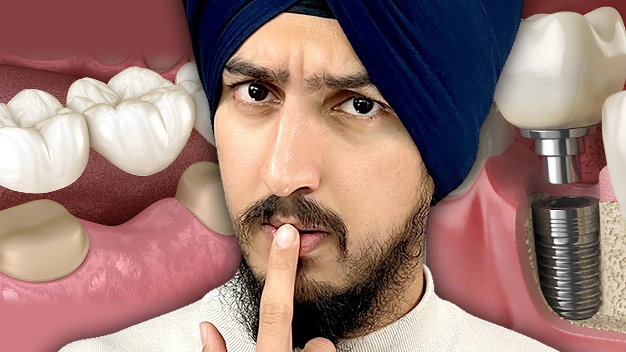 Should You Avoid Dental Implants?