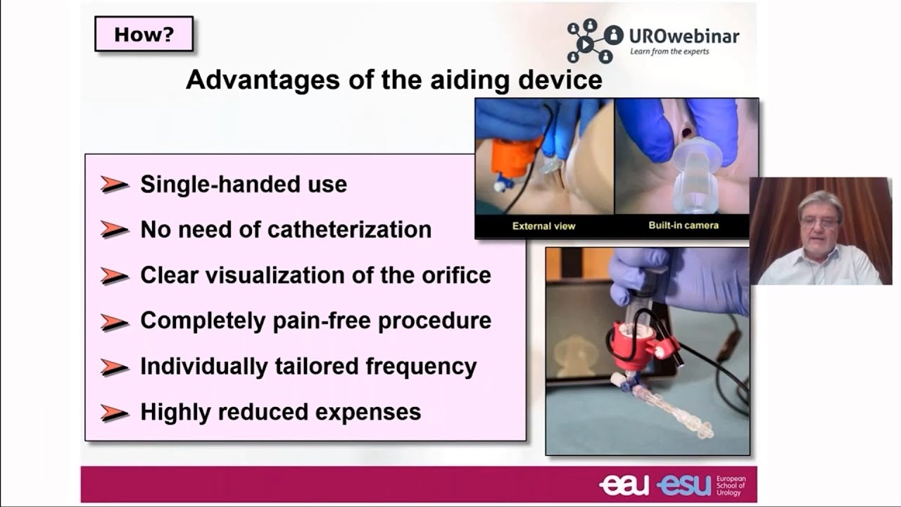 Intravesical instillation therapy in IC/BPS 2020