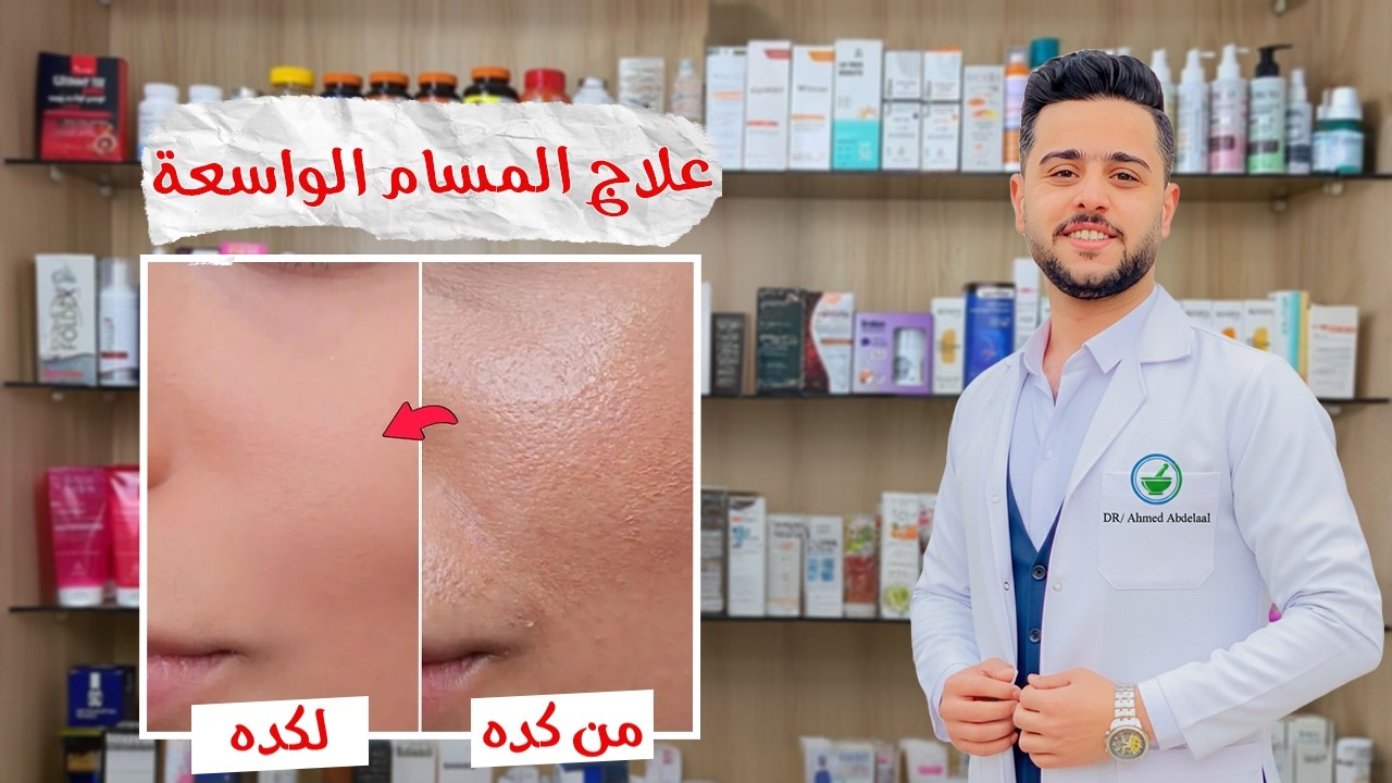 ليه مسام بشرتك واسعه ...؟ وازاي تعالجيها وتخلي بشرتك مشدودة في وقت بسيط #مسام_واسعة