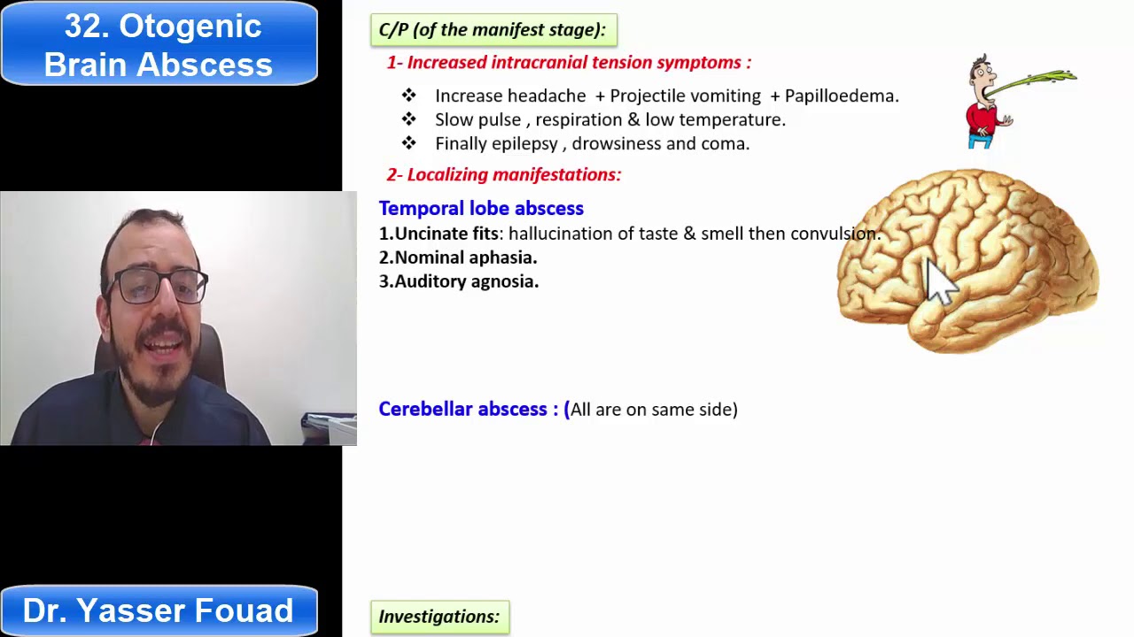 32  Otogenic Brain Abscess