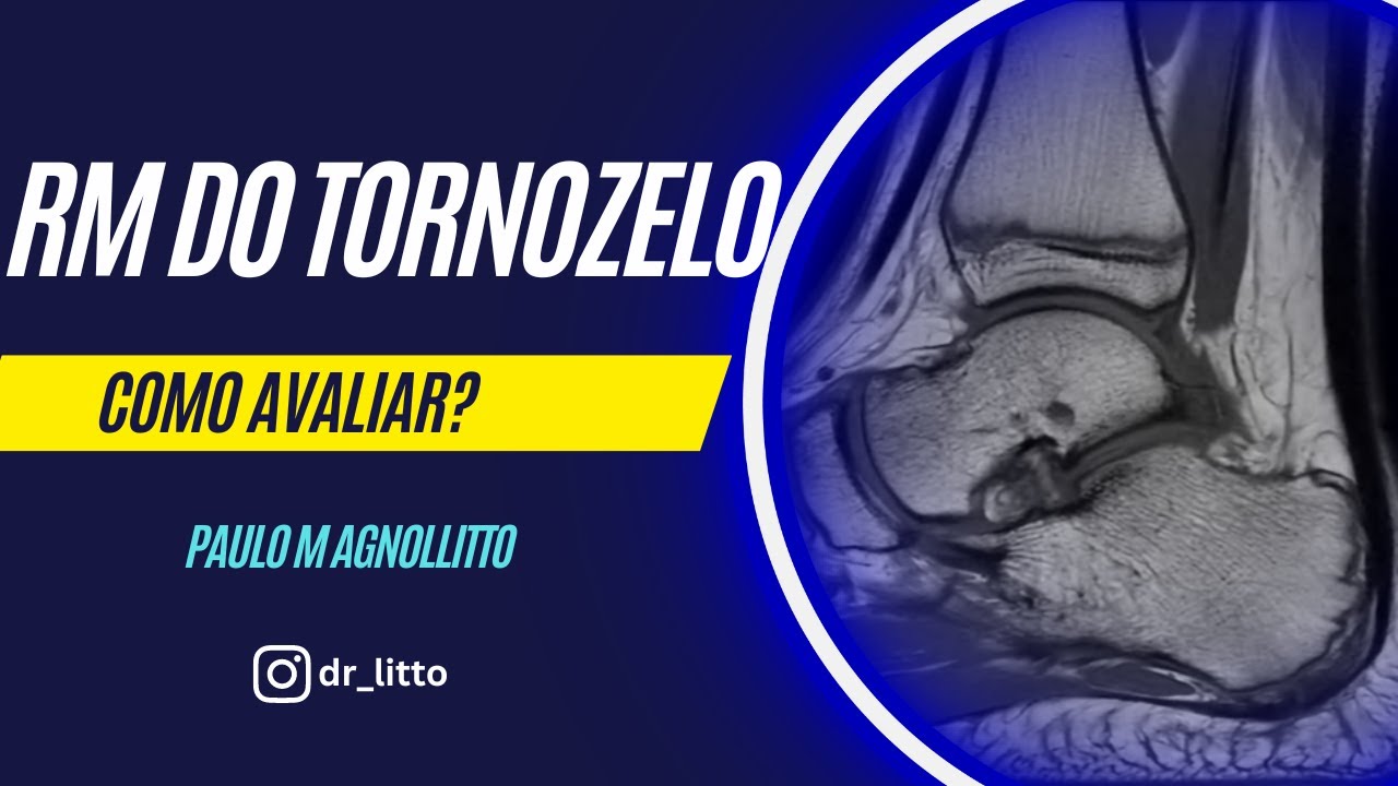 RM DO TORNOZELO: COMO AVALIAR?
