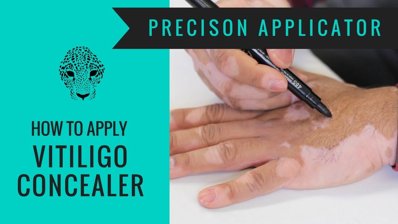 Vitiligo Makeup Tutorial - How to Cover Vitiligo - Zanderm Precision Applicator
