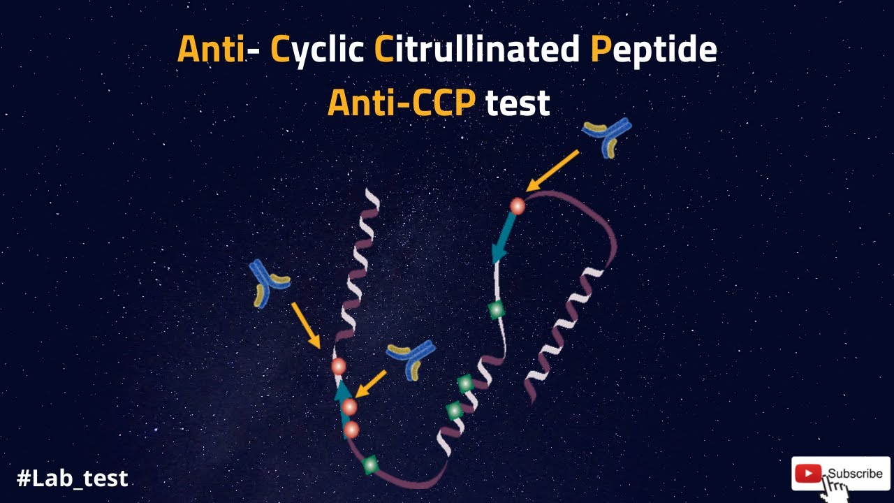 Anti-Cyclic Citrullinated Peptide (Anti-CCP)