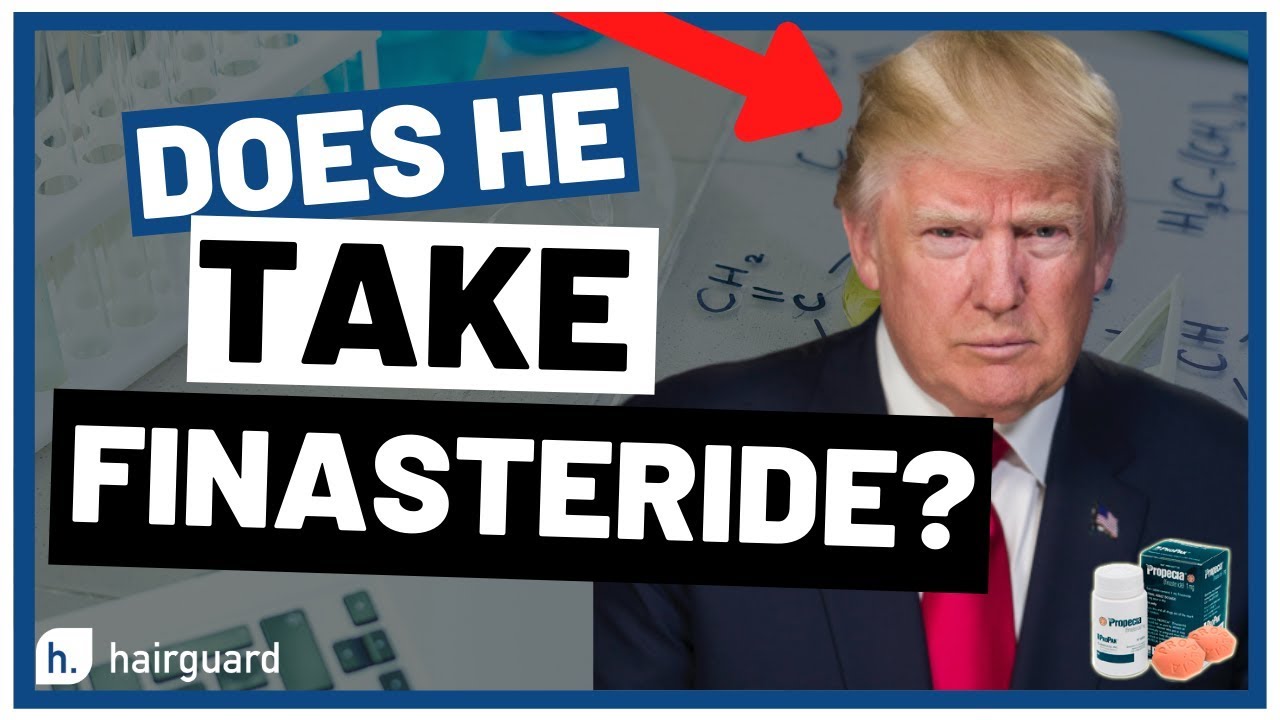Donald Trump Hair Loss - Does He Take Finasteride?