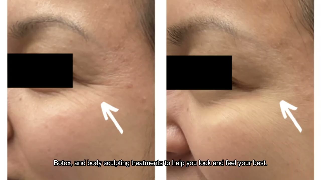 Recharge Lab IV Lounge  Med Spa