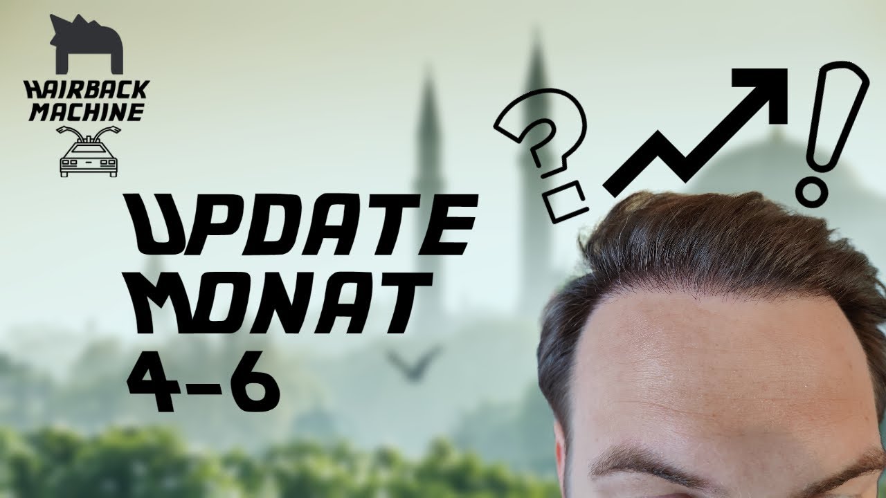 Update Monat 4-6 │Haartransplantation Instanbul │Cosmedica Klinik - Dr. Acar