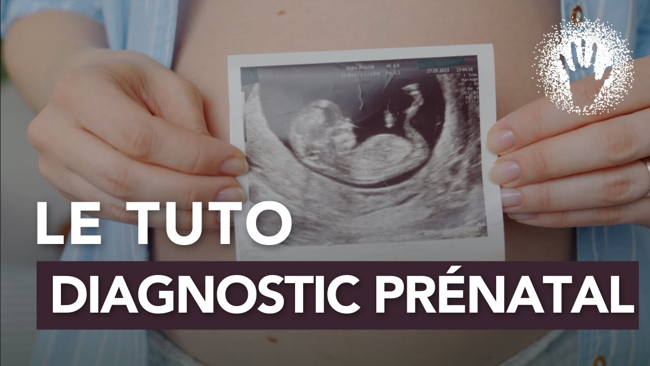 Le tuto diagnostic prénatal
