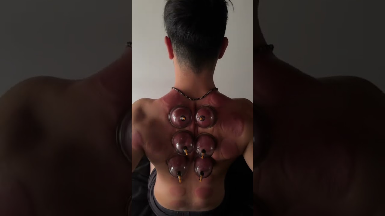 Attivazione dei muscoli nella schiena con le coppette per info (3661369122)