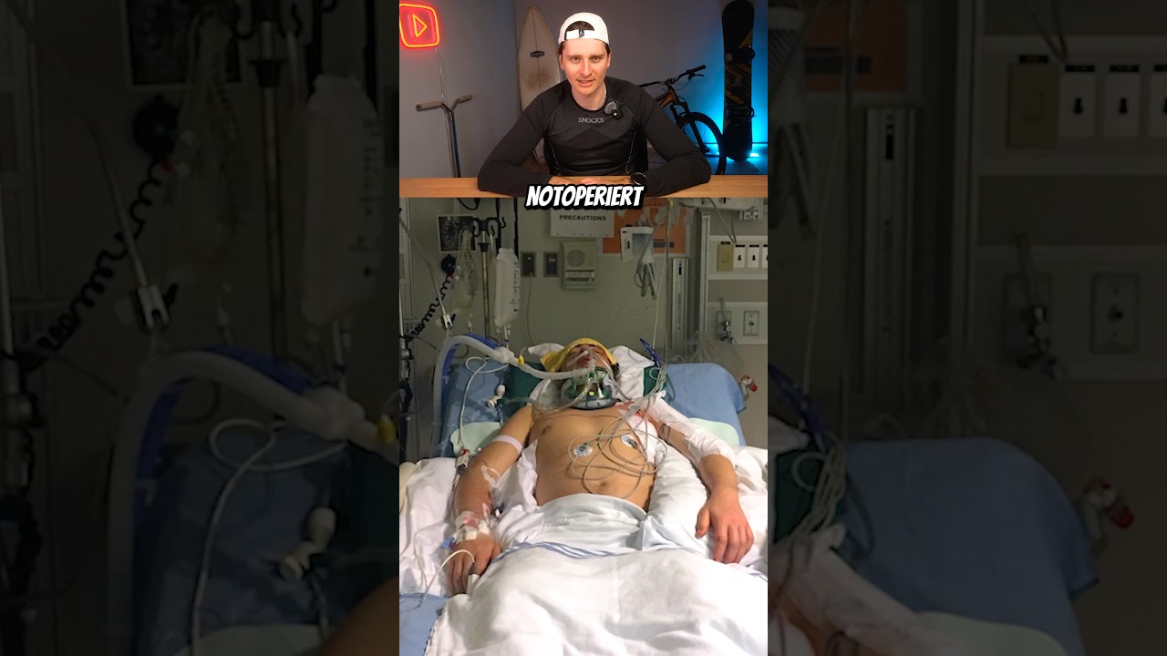Krassester Snowboard Unfall jemals? #markmcmorris