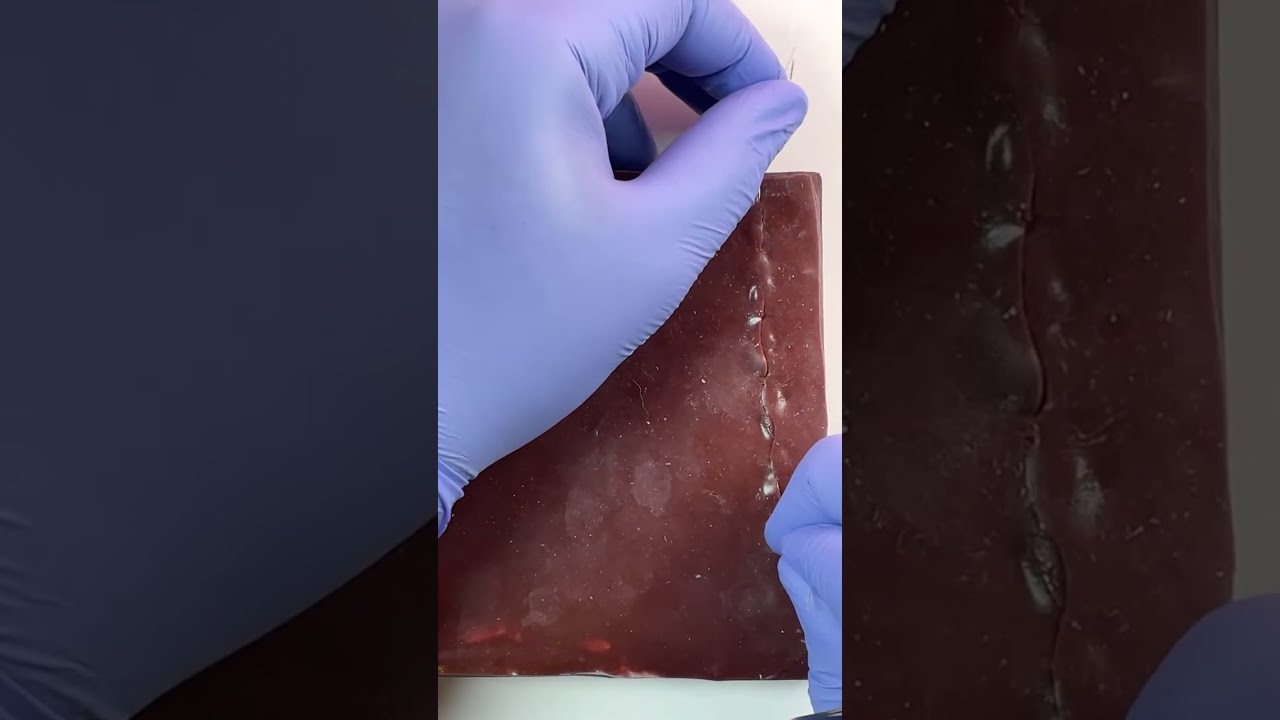 Basic Surgical Skills | 3 sutures EVERY DOCTOR NEEDS!