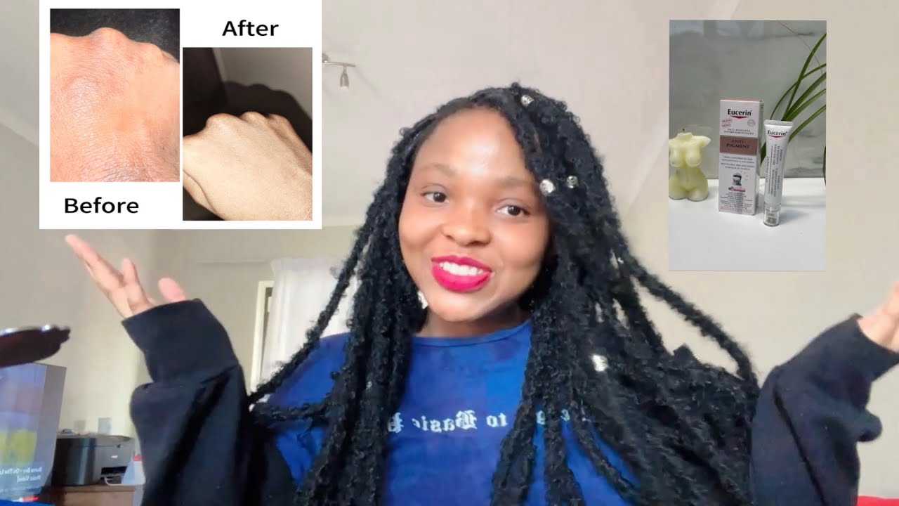 My skin journey *how I cured my eczema with photo evidence before and after* South African YouTuber