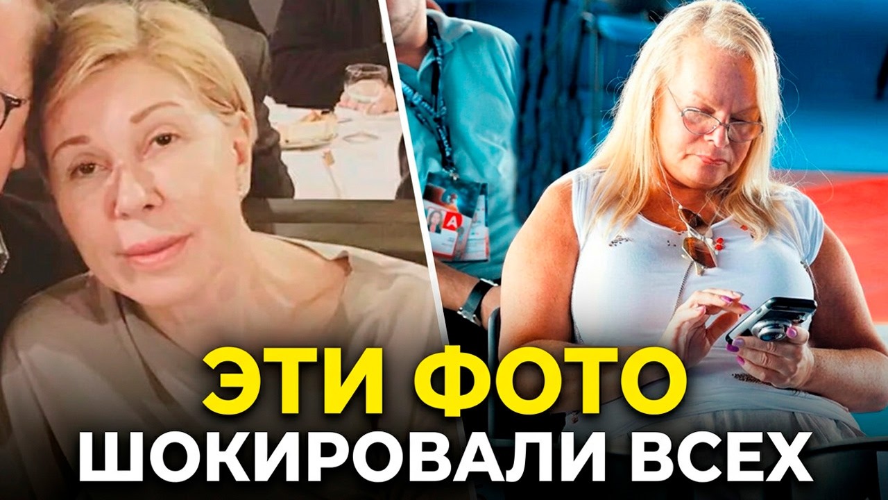 ВЫ БУДЕТЕ ШОКИРОВАНЫ! ОПУБЛИКОВАНЫ ФОТОГРАФИИ НАШИХ ЗВЁЗД БЕЗ КОСМЕТИКИ!