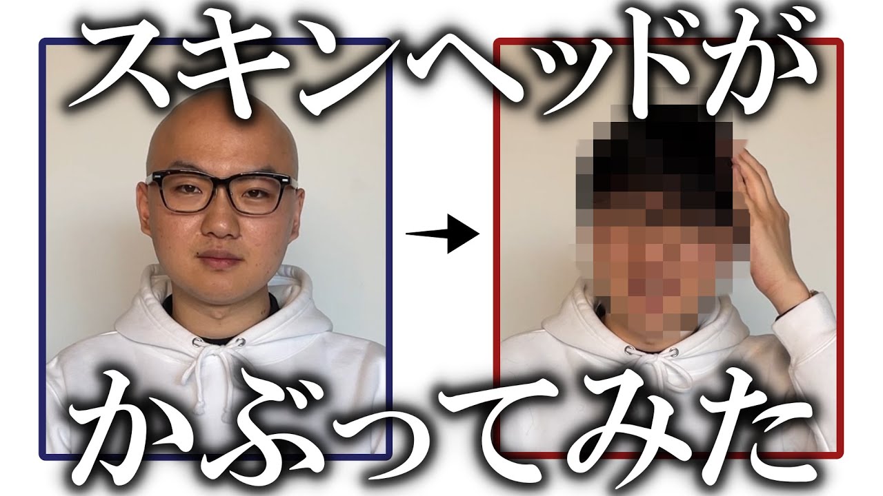 メンズウィッグ3種類を徹底比較｜カツラの選び方を紹介します