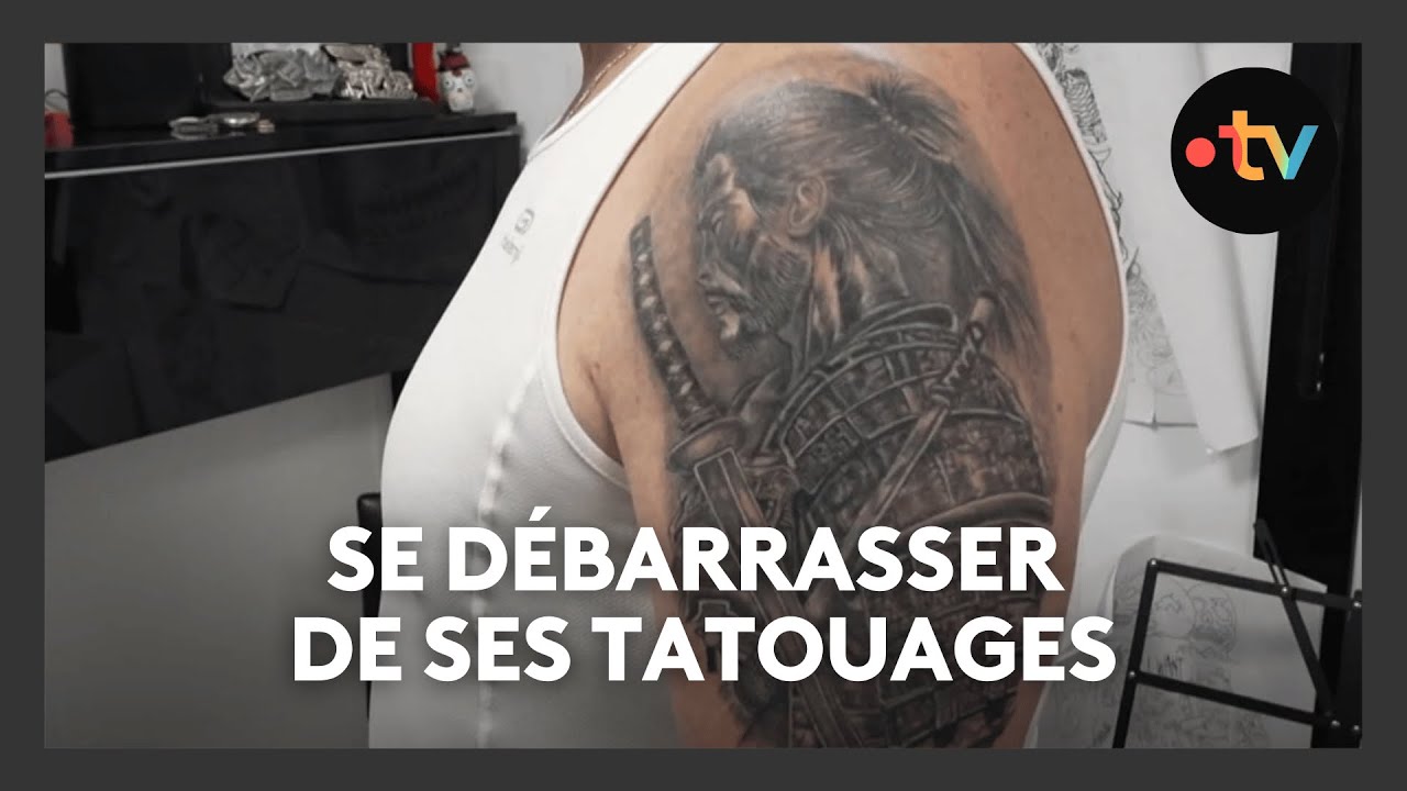 Le tatouage 4/4 : se débarrasser de ses tatouages
