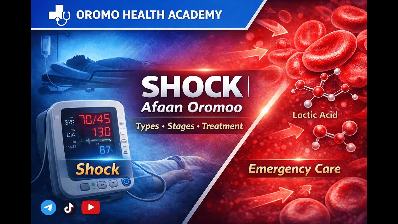 Shock Explained in Afaan Oromoo | Types, Stages & Emergency Care