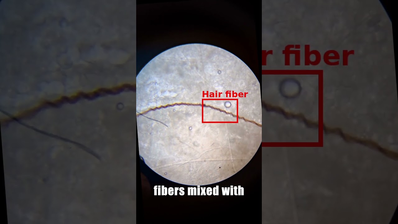 What&rsquo;s Hiding Inside Your Earbuds? 🔬🪱 Microscope Reveal