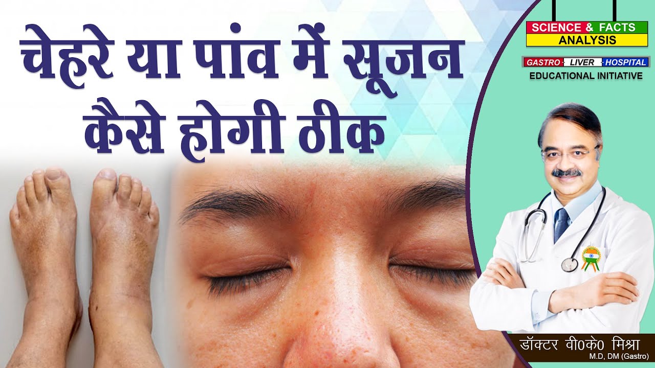 चेहरे या पांव में सूजन कैसे होगी ठीक || HOW FLUID RETENTION AFFECTS DIFFERENT PARTS OF YOUR BODY
