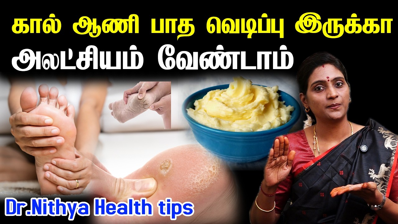 கால் ஆணி குணப்படுத்த இதை செய்ங்க | Foot Corn & Callus explained in Tamil | ஆணி கால்patha vedippu