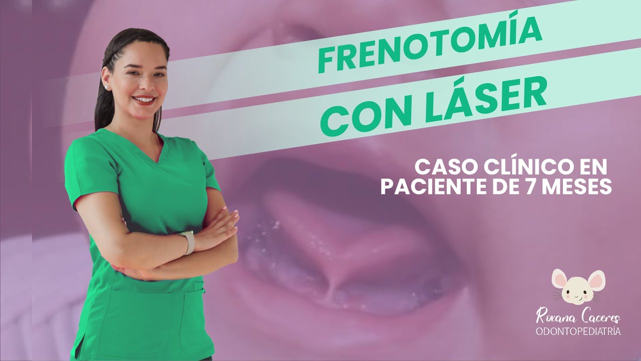 FRENECTOMÍA LINGUAL CON LÁSER EN BEBÉS
