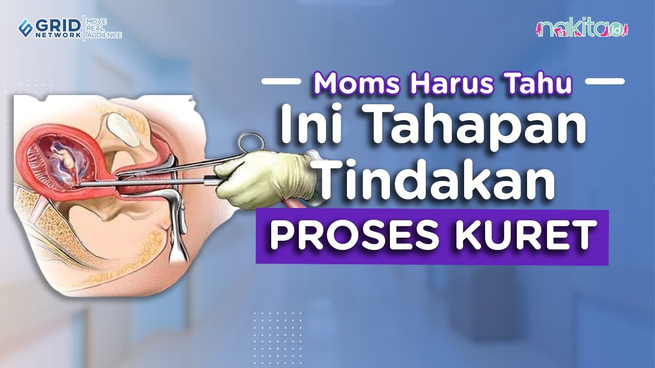 Wajib Tahu! Ini Tahapan Tindakan Proses Kuret