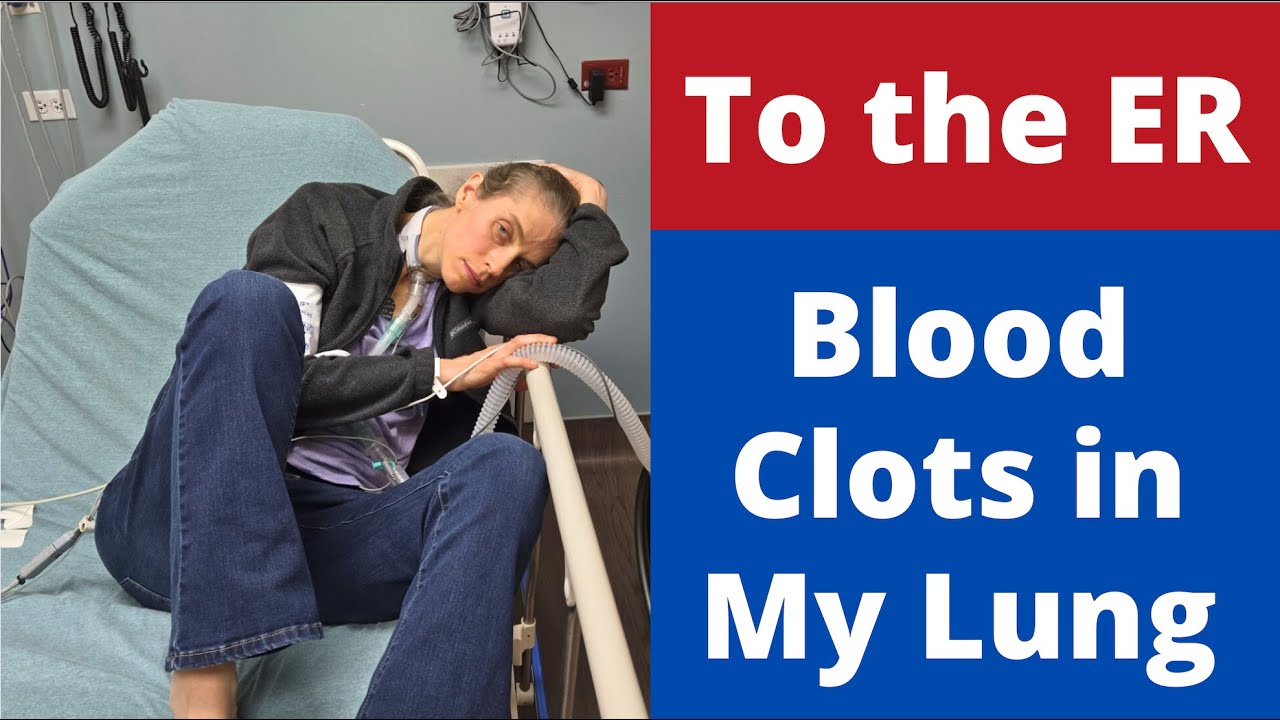 To the Emergency Department. Blood Clots in My Lung. Pulmonary Emboli. Life with a Vent