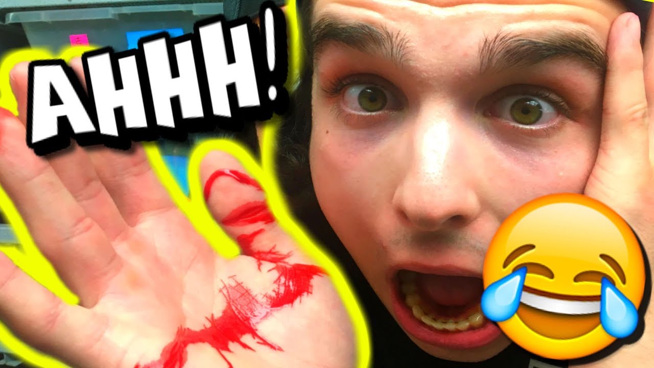 FUNNIEST SNAKE BITES EVER!! | BRIAN BARCZYK