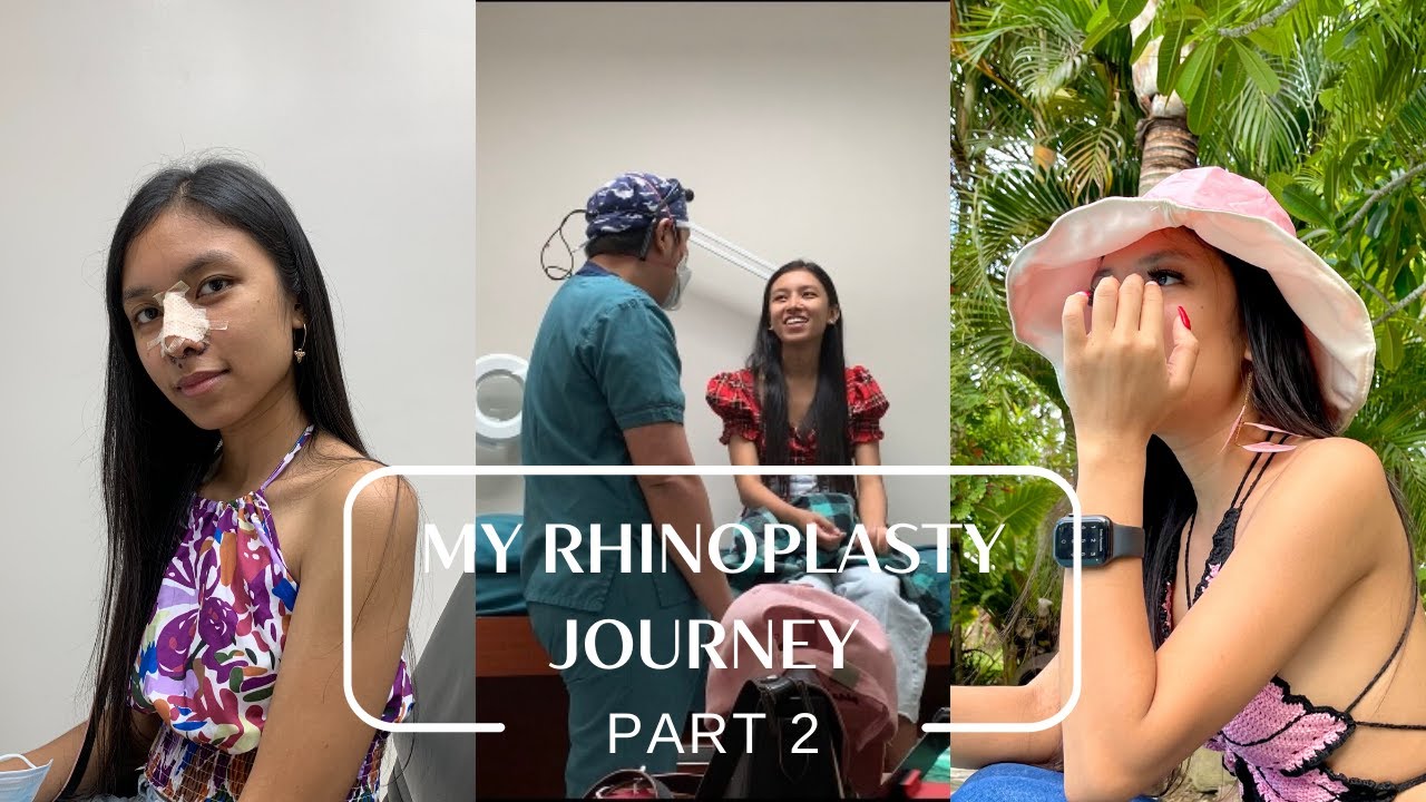RHINOPLASTY JOURNEY PART 2 | DOC NATO PASCUAL | Shayrie Wynne | Philippines