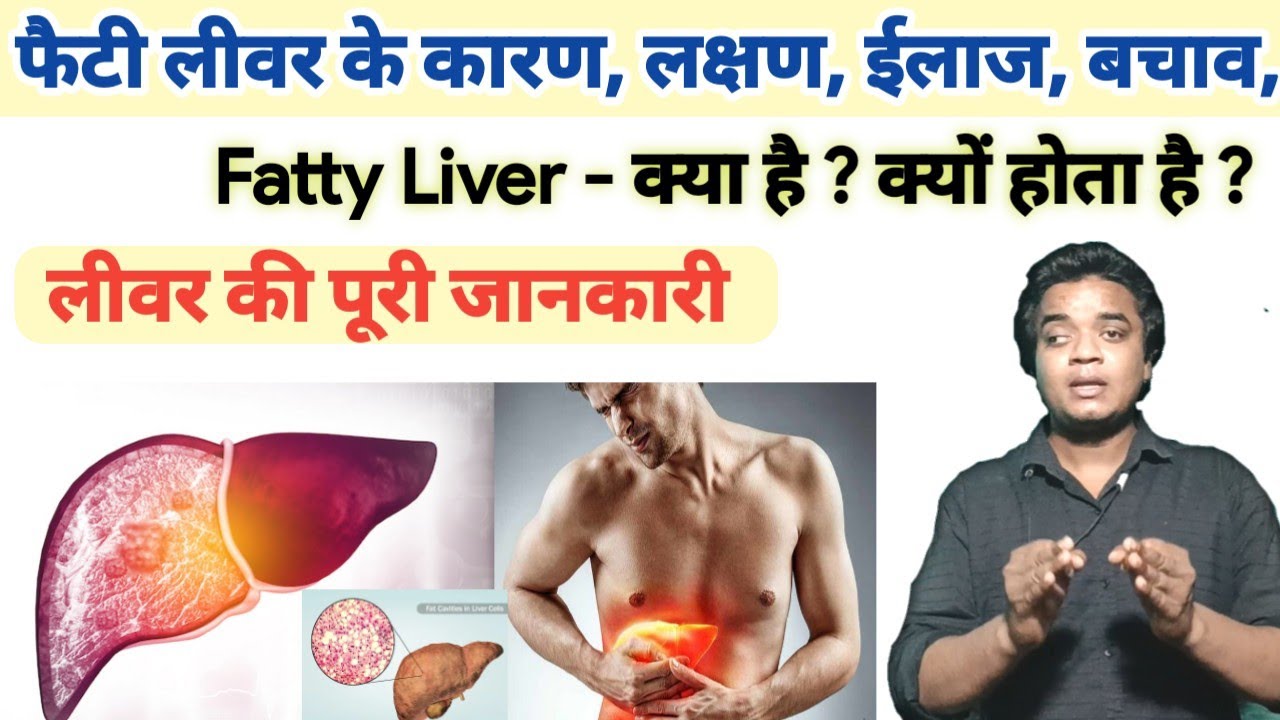 फैटी लीवर का पूरा इलाज || फैटी लीवर क्या है क्यों होता है ? कारण | लक्षण | ईलाज | Hepatic steatosis
