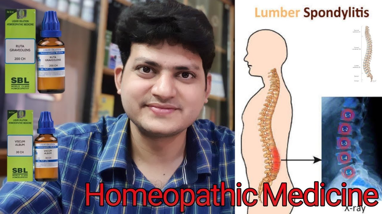 Homeopathic Medicine for lumbar Spondylitis ? बहुत तेज कमर दर्द ।