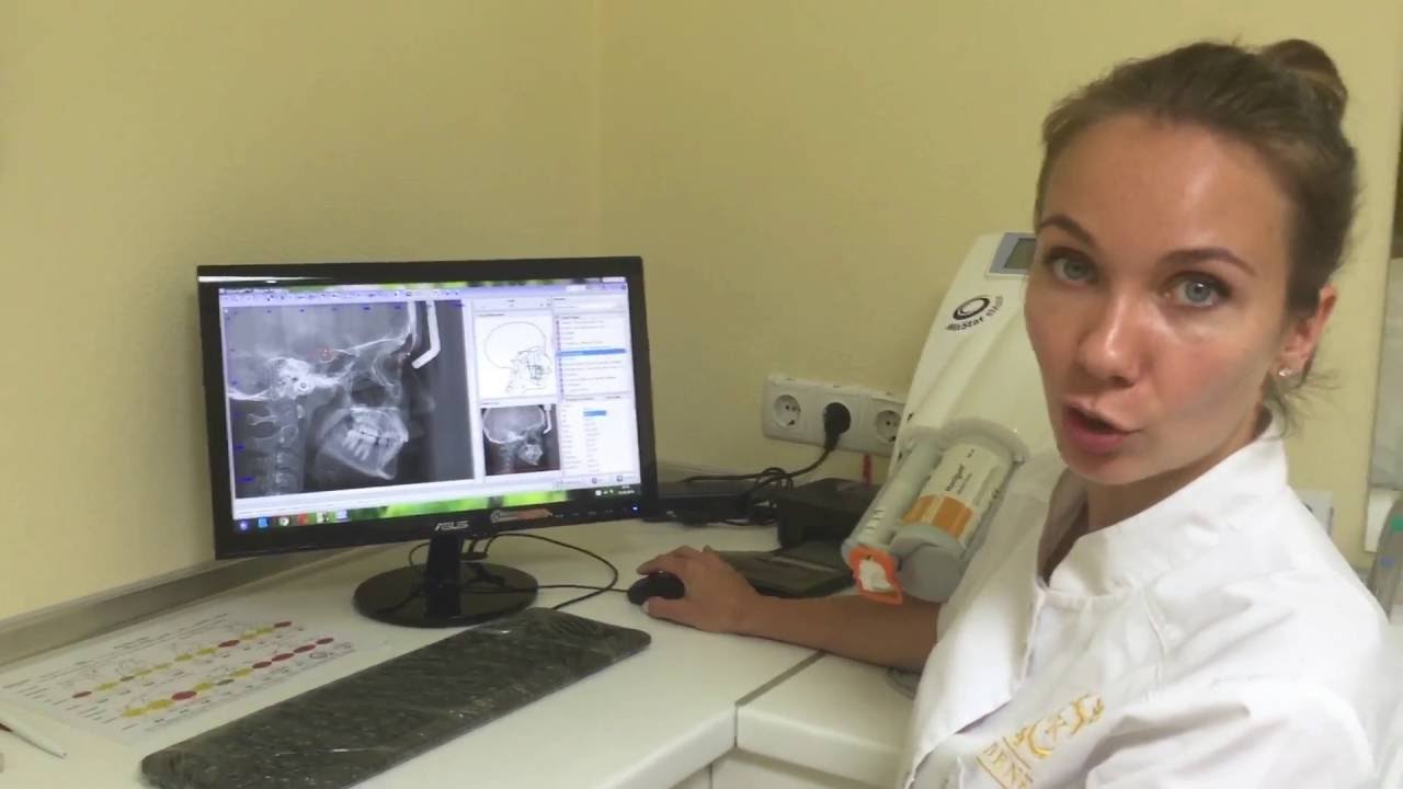 Телерентгенограмма. Установка точек в программе OnyxCeph. Cephalometric landmarking in OnyxCeph