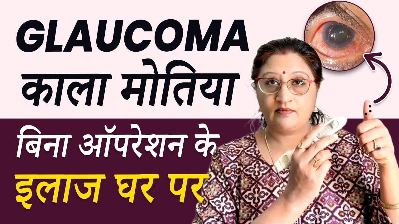 How To Cure Glaucoma Treatment Naturally || Acupressure Points