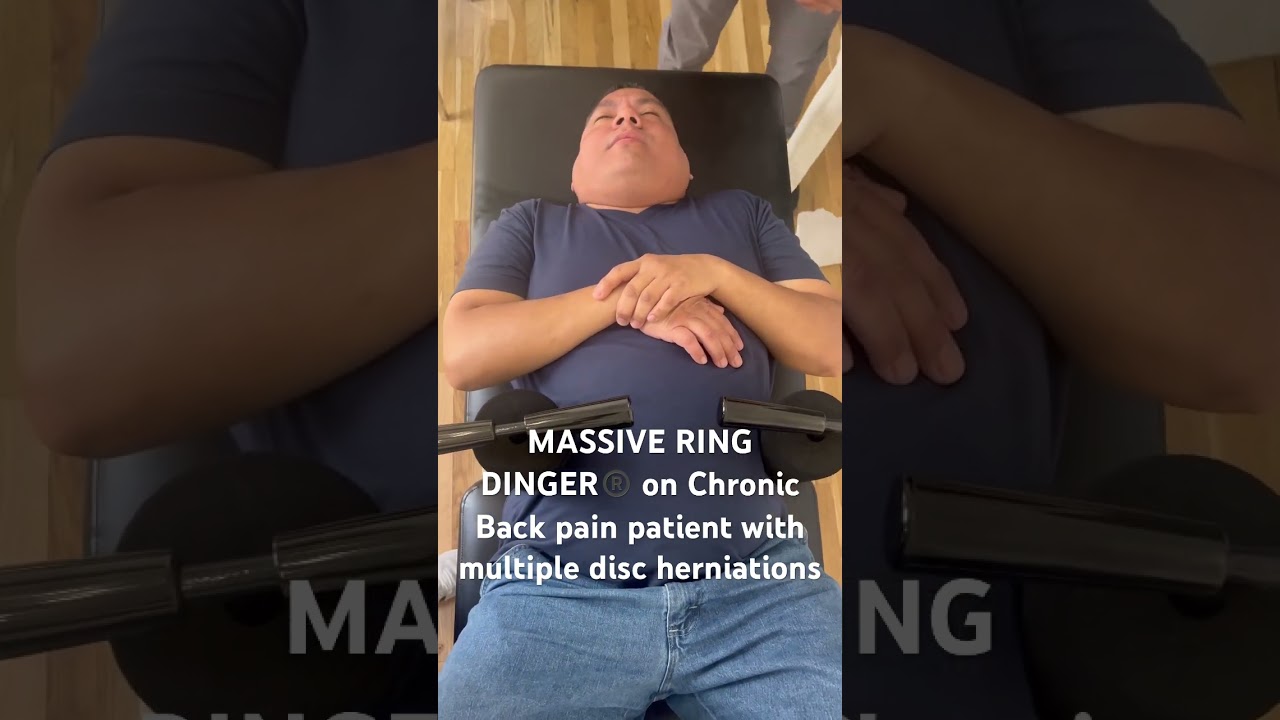 3 solid years of back pain responds beautifully to MASSIVE Ring Dinger&reg;️manual spinal decompression