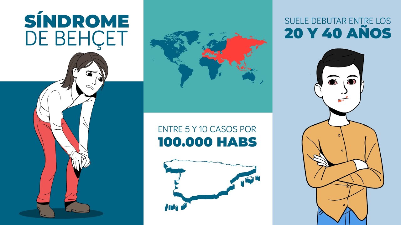 Síndrome de Behçet: qué es, síntomas, tratamientos y consejos.