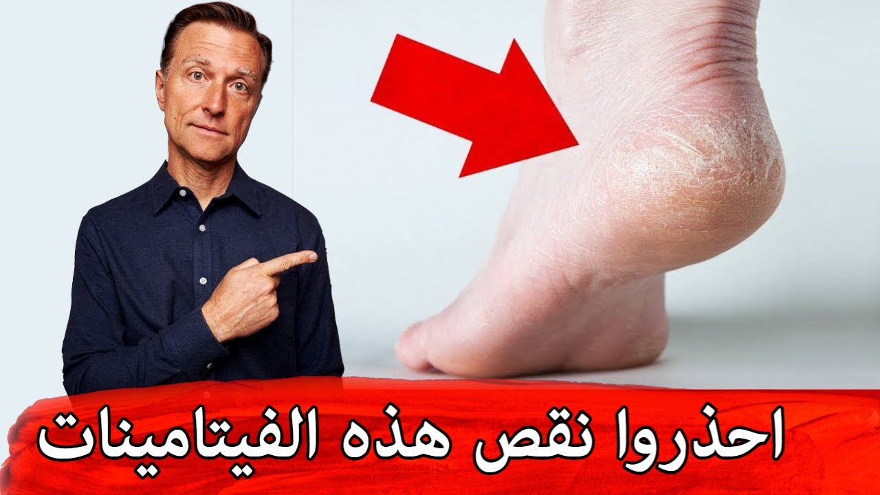 علامات نقص الفيتامينات للأظافر والجلد والشعر التي يعاني منها أغلب الناس