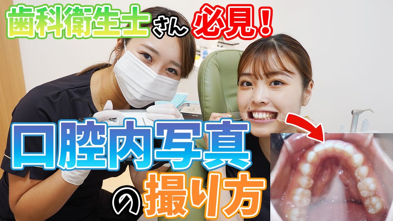 【歯科衛生士さん必見】口腔内写真の撮り方を分かりやすく解説しちゃいます！【名古屋茶屋歯科・矯正歯科】