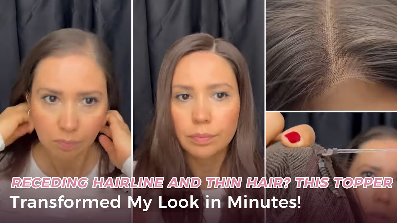 Receding Hairline and Thin Hair? This Topper Transformed My Look in Minutes! | UniWigs Breeze